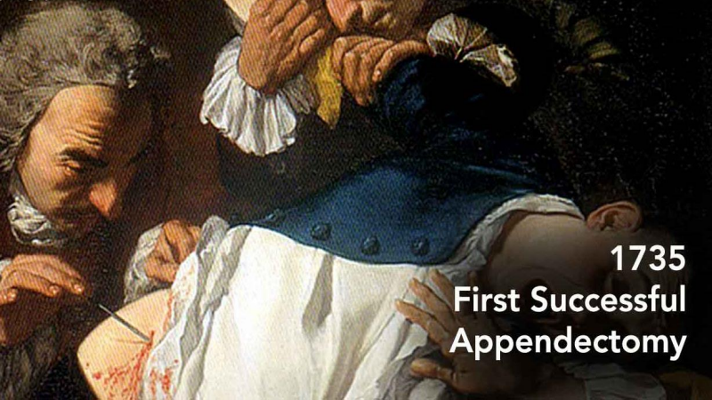 ERAS Enhanced Recovery After Surgery